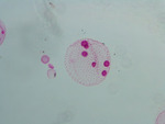 MISSING THUMBNAIL